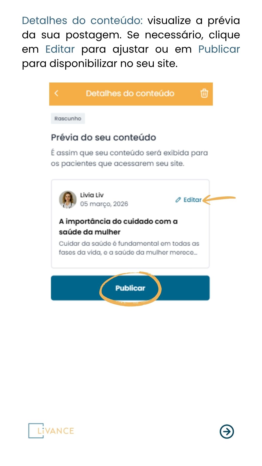 criar_post_blog_7.jpg