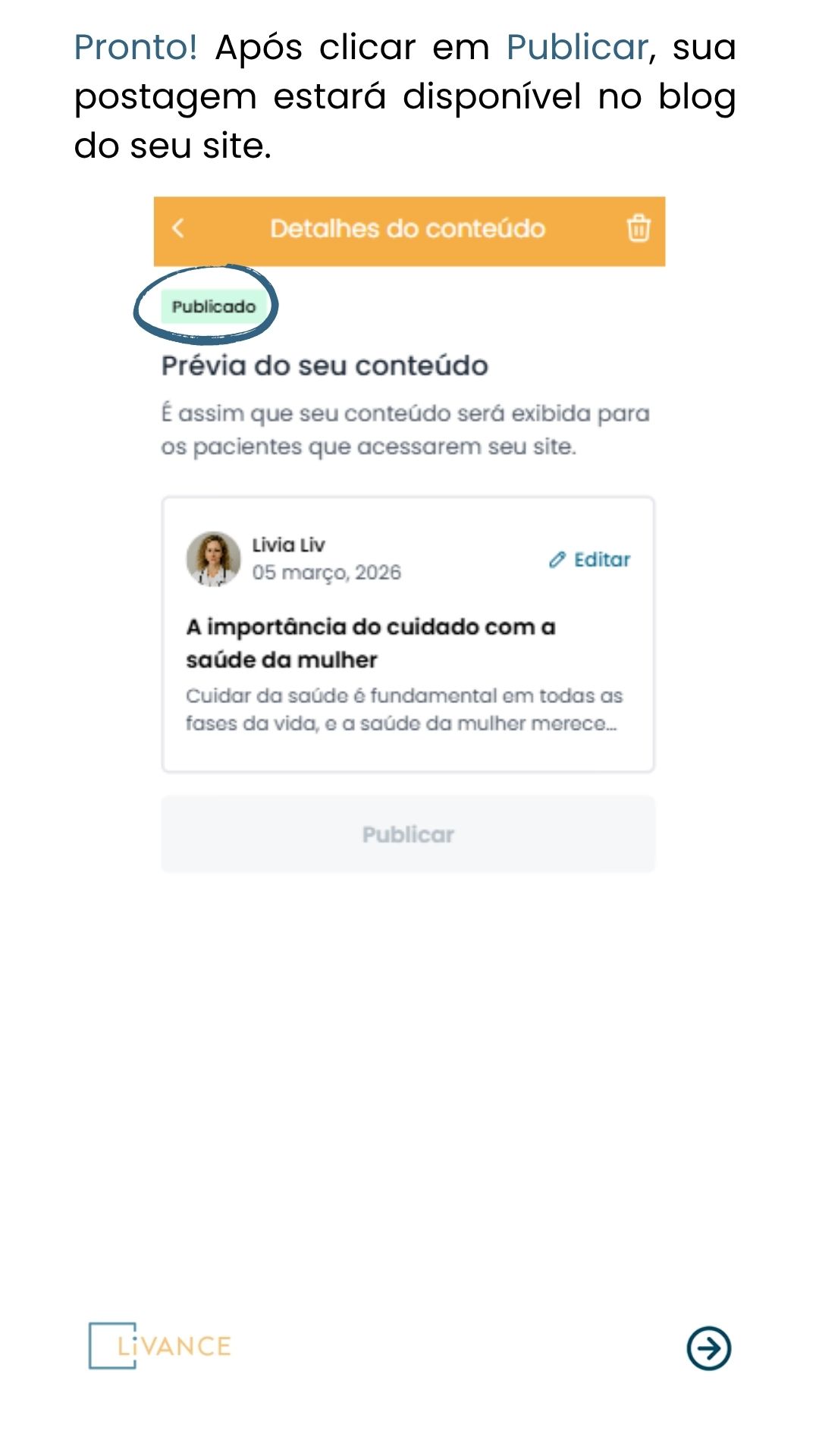 criar_post_blog_8.jpg